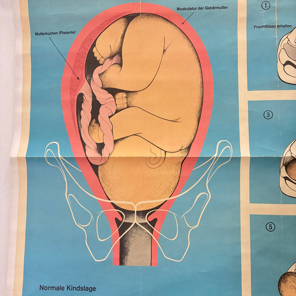 Vintage School Chart – Stages of Birth – Biology Educational Chart, Rolled, Used