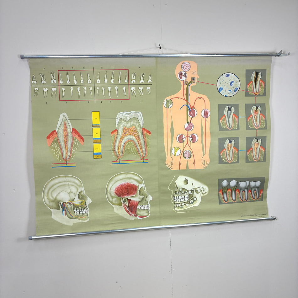 Vintage Schulkarte – Das menschliche Gebiss – Biologie Lehrtafel Rollbild Wanddeko