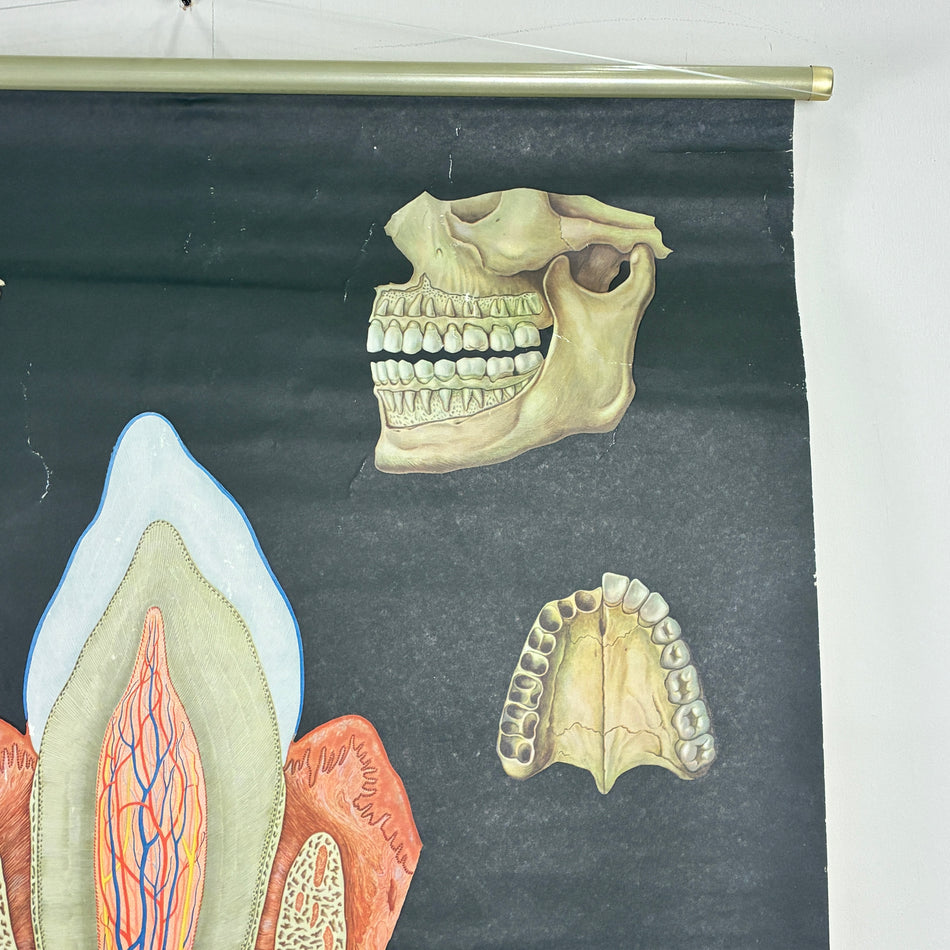 Vintage Schulkarte Aufbau der Zähne Hygiene-Museum Anatomie Lehrtafel Wanddeko