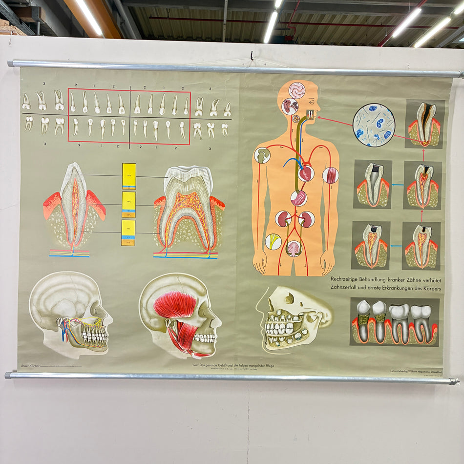 Vintage school chart – The Dentition – Hagemann Biology Medical Teaching Chart, Scroll Format, Used