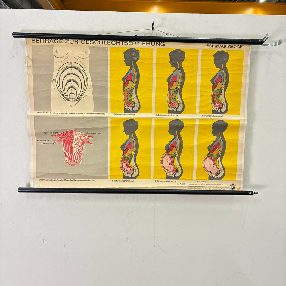 Vintage School Chart – Pregnancy – Biology Medicine Educational Chart Roll-up Used