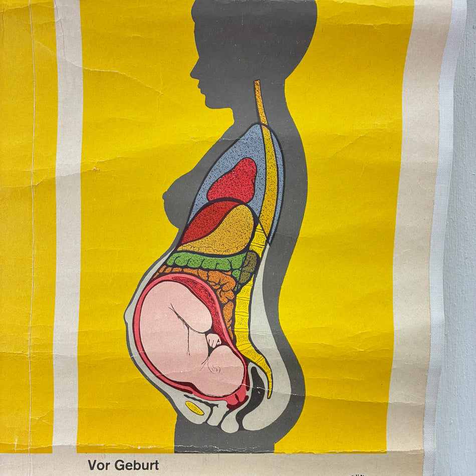 Vintage School Chart – Pregnancy – Biology Medicine Educational Chart Roll-up Used
