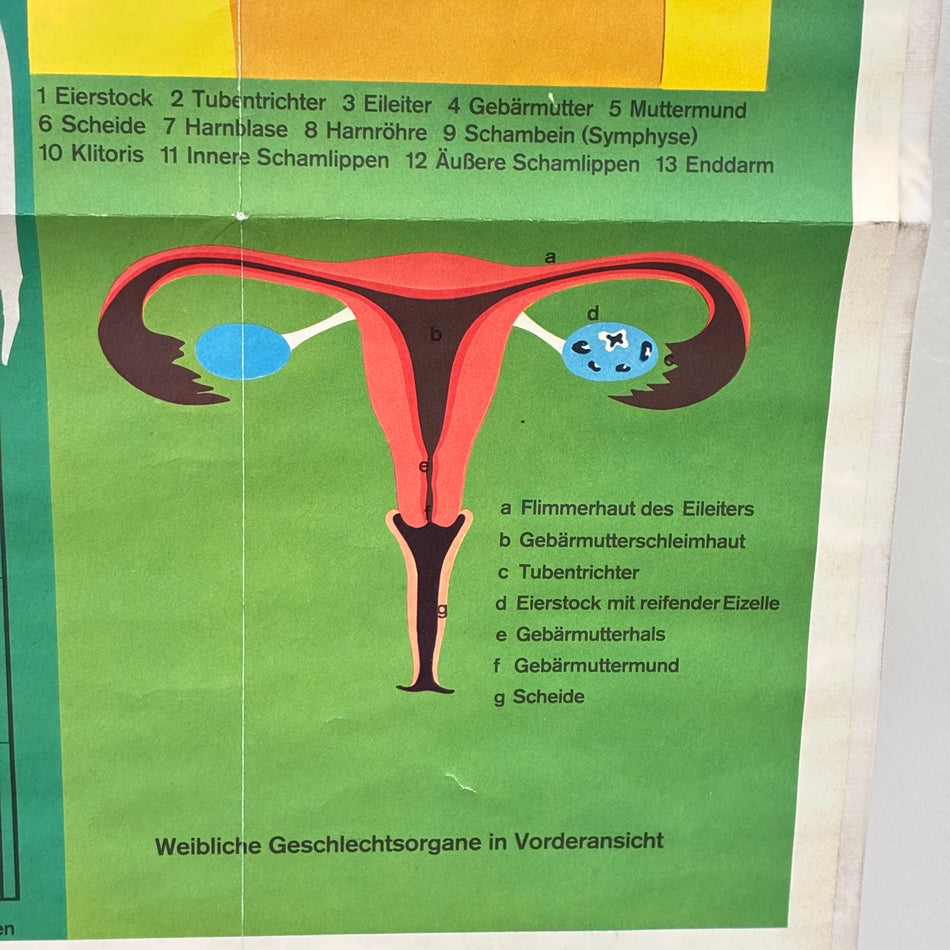 Vintage school chart – The sexes – Biology/Medicine teaching chart, roller chart, used