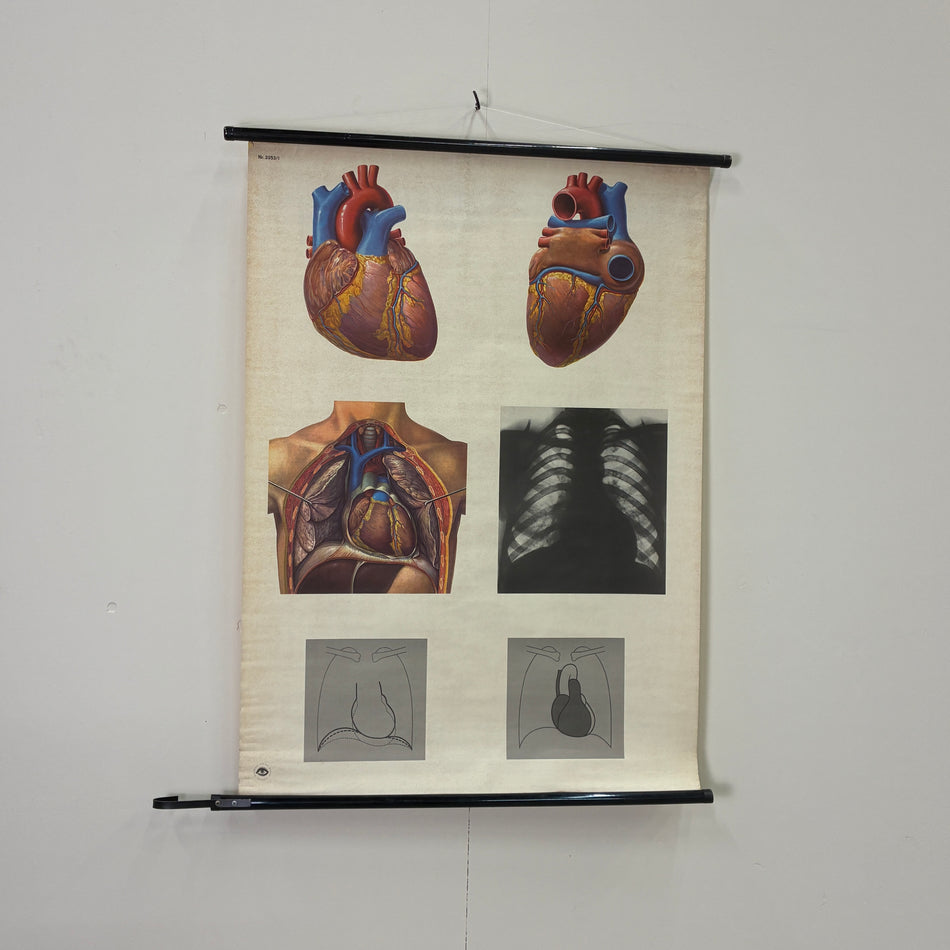 Vintage Schulkarte Das Herz Röntgenbild Anatomie Rollbild Lehrtafel Kardiologie Wanddeko