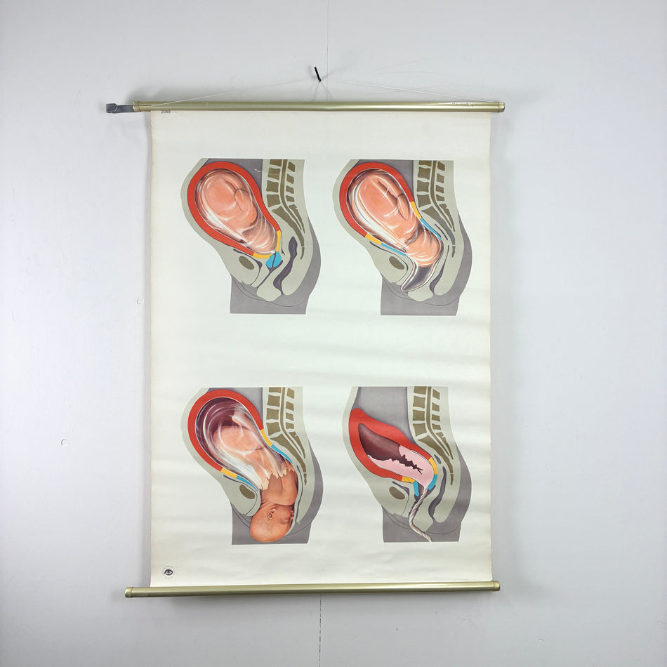 Vintage Schulkarte Entwicklung Schwangerschaft Hygiene-Museum Anatomie Lehrtafel Wanddeko