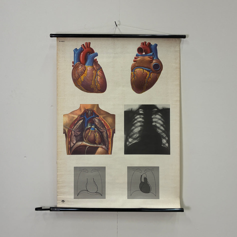 Vintage Schulkarte Das Herz Röntgenbild Anatomie Rollbild Lehrtafel Kardiologie Wanddeko