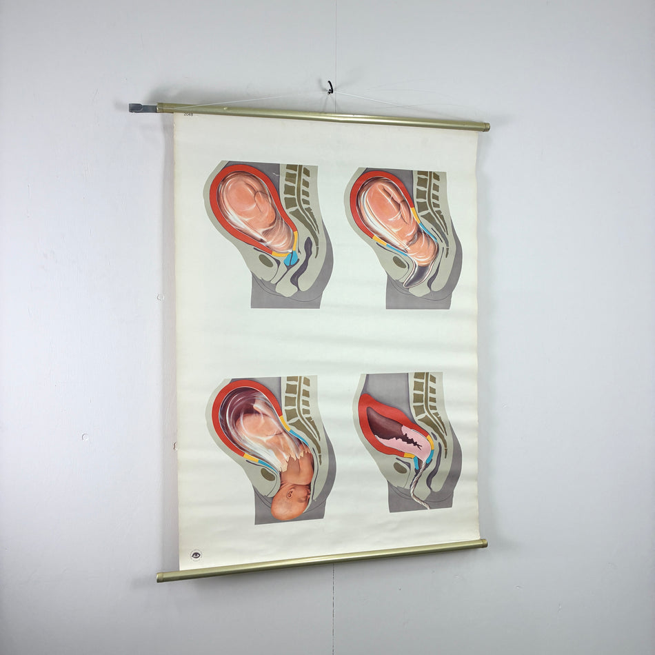 Vintage Schulkarte Entwicklung Schwangerschaft Hygiene-Museum Anatomie Lehrtafel Wanddeko